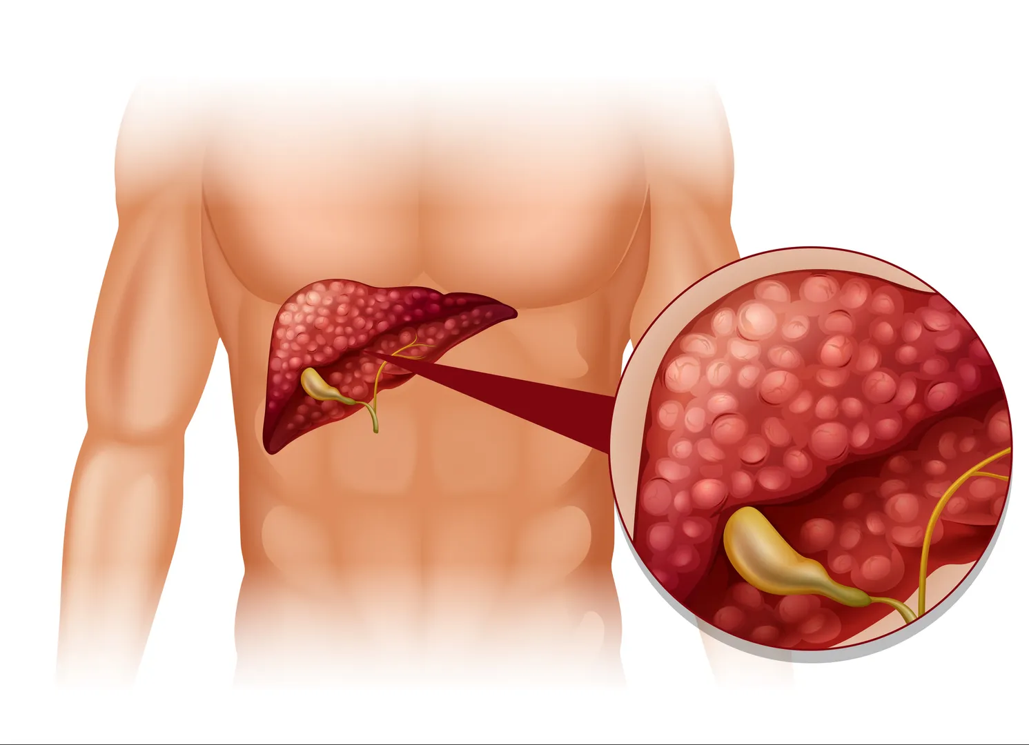 Liver Biopsy Alternatives in Mumbai for Safer Liver Evaluation