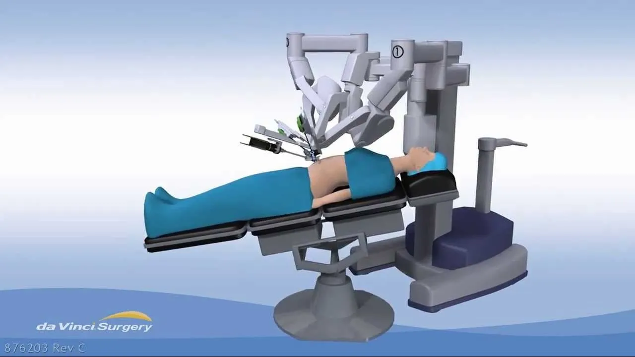 Robotic Cholecystectomy in South Mumbai – Advanced Gallbladder Surgery
