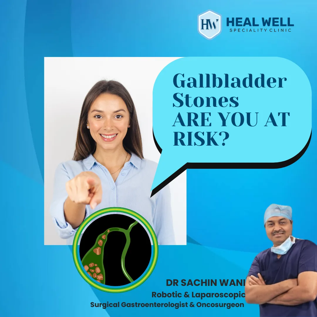Gallbladder stones: Are you at risk?