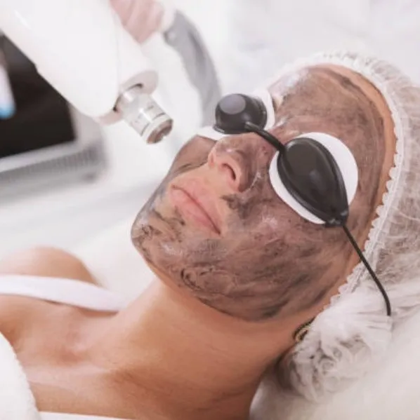 Laser Peel treatment
