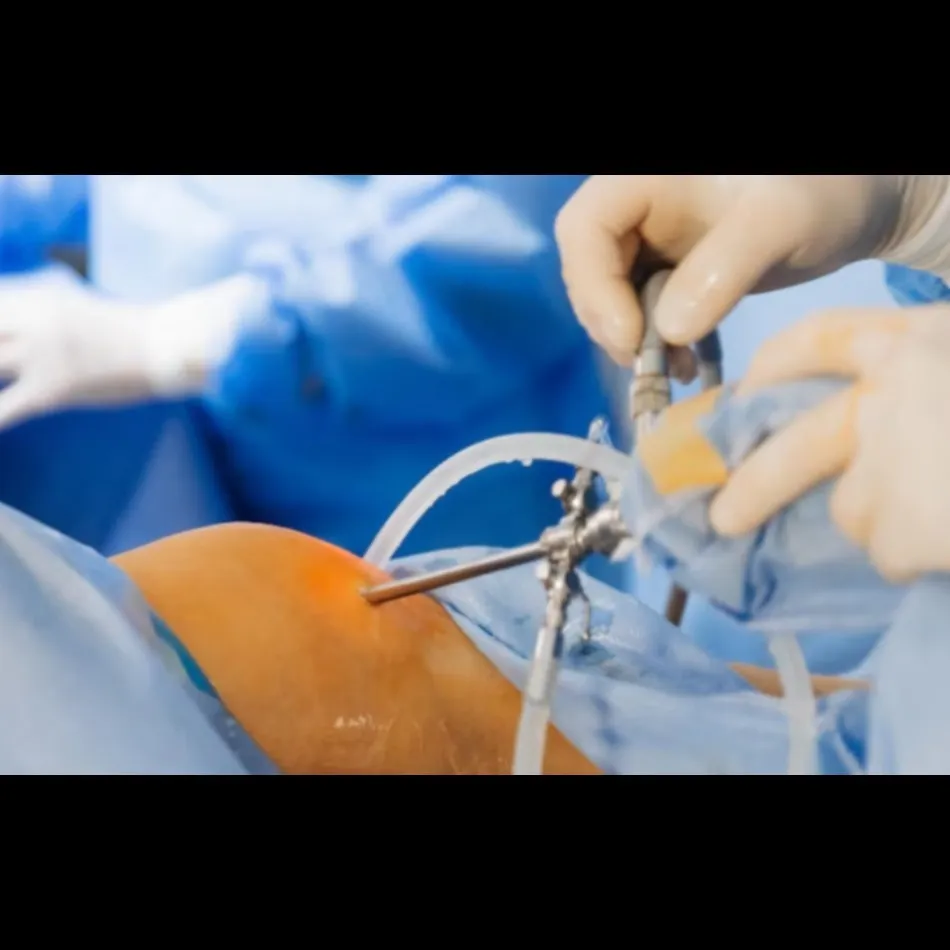 Meniscal Repair in Hennur – Orthopedic Surgery