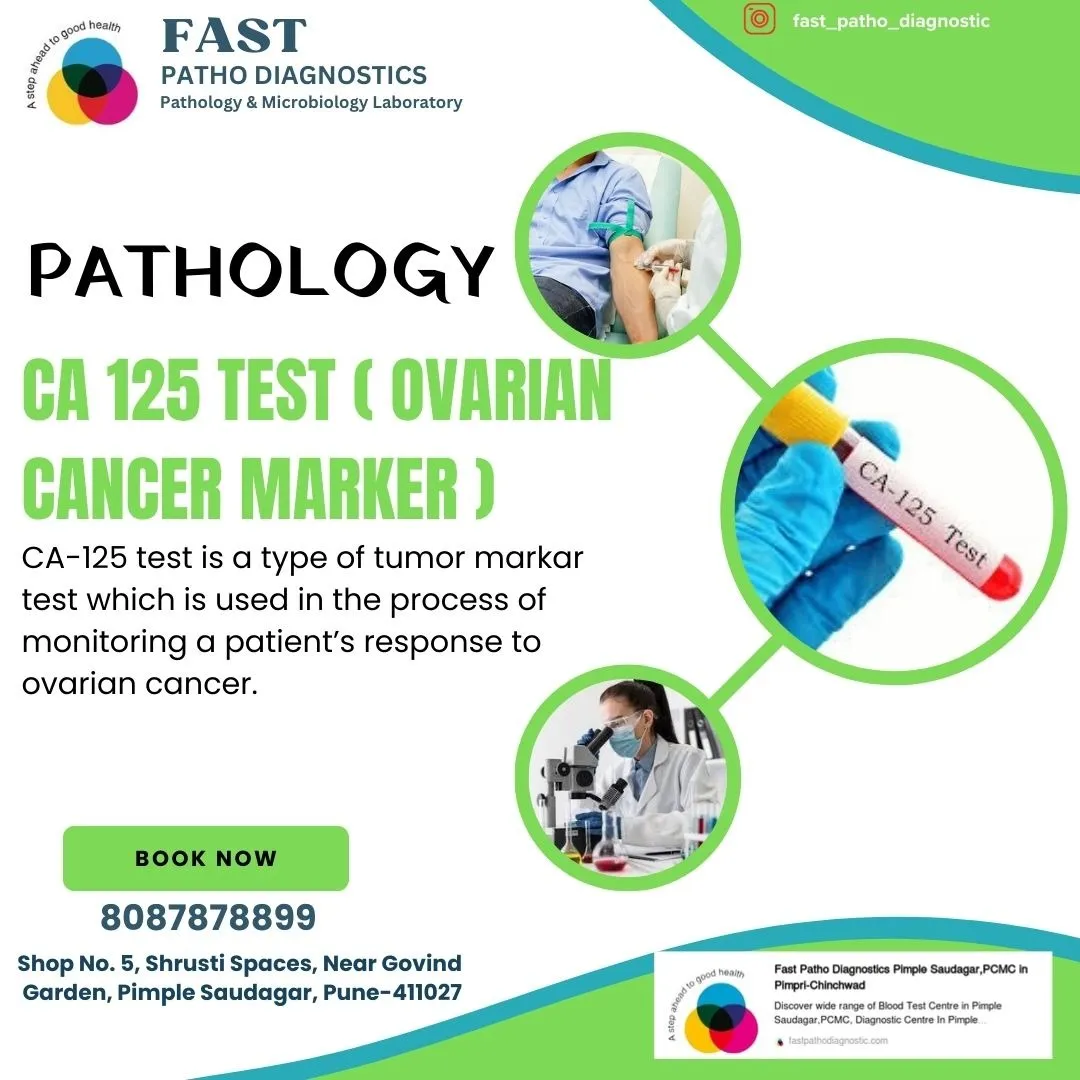 CA 125 TEST { Ovarian Cancer Marker }