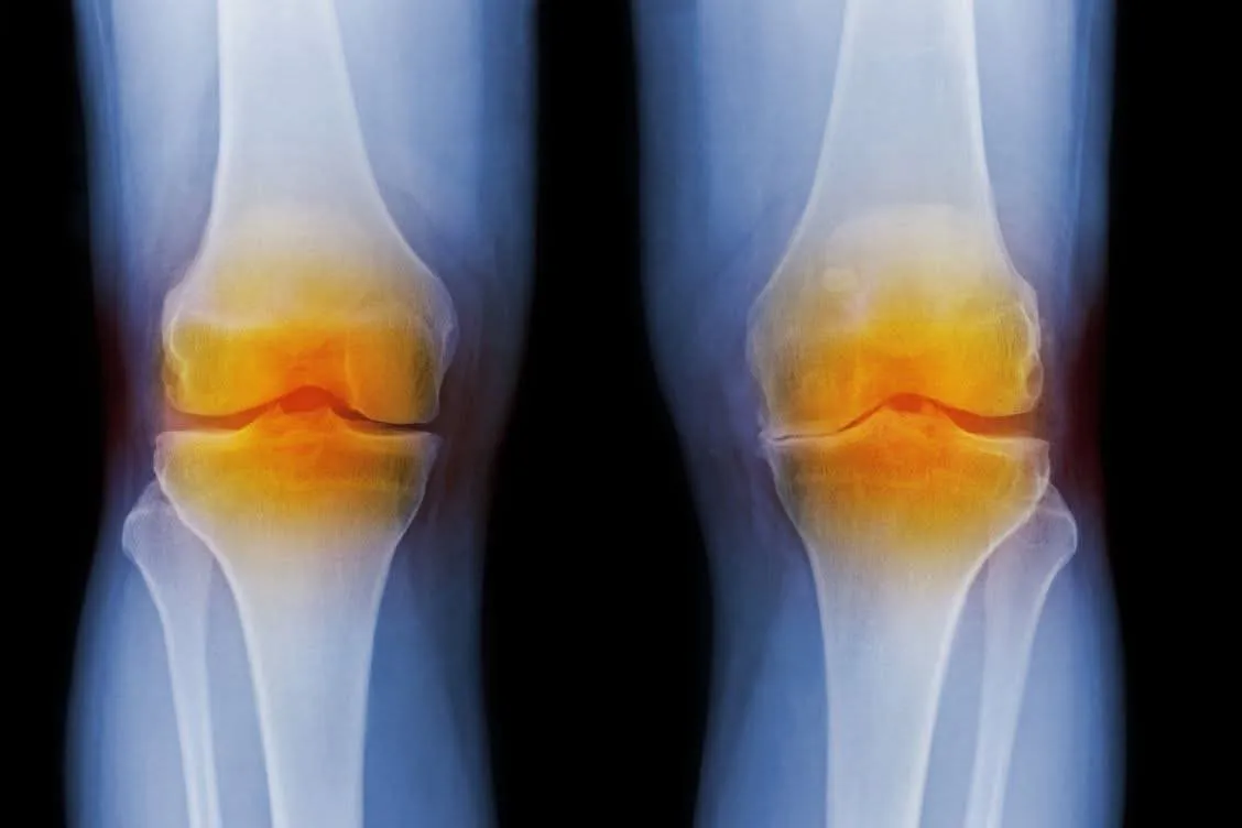 Best Ayurvedic Knee Treatment in Vartak Nagar