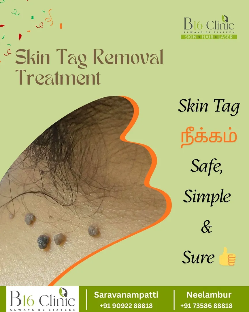 Skin Tag Removal Treatment at B16 Clinic
Looking for a safe and effective skin tag removal?
At B16 ...