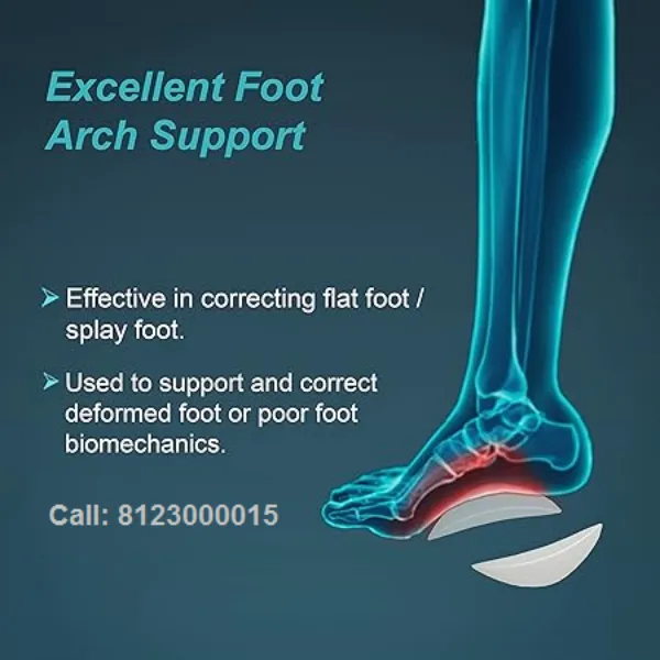 Arch Support MCR MCP supplier in whitefield