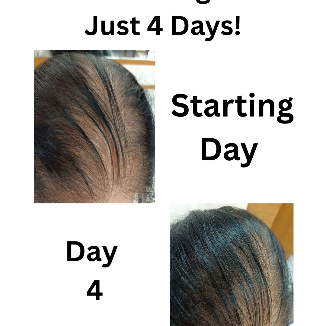 Best Ayurvedic Hair Treatment Center in Vartak Nagar
