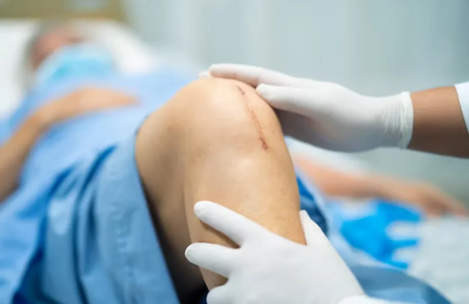 Computer Guided Knee Replacement in Bangalore – Accuracy That Improves Outcomes