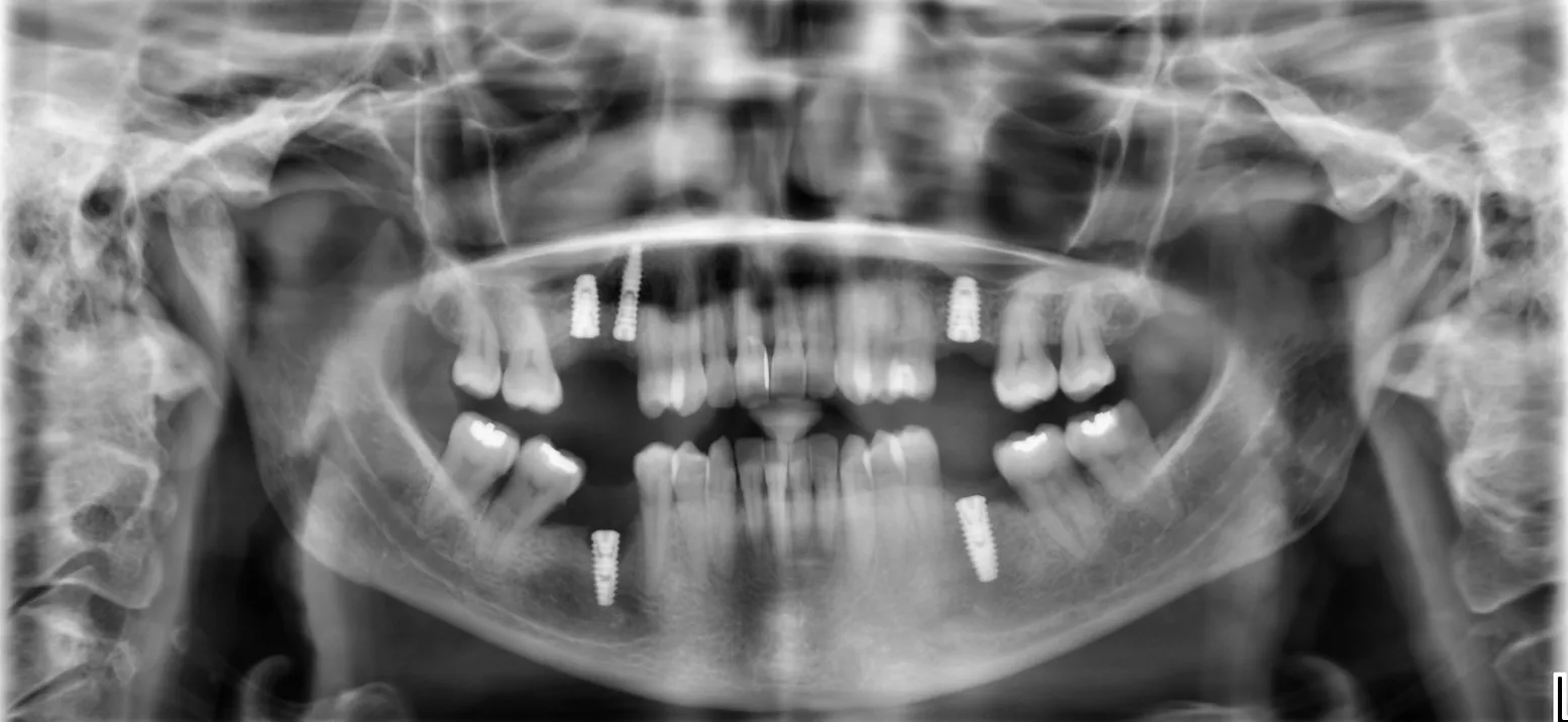 CBCT Scans – Why They Matter in Modern Dentistry