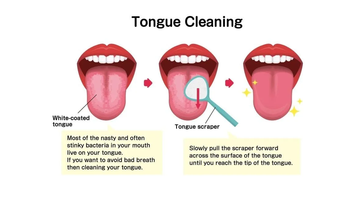 Bad Breath Solutions – How Professional Cleaning Helps