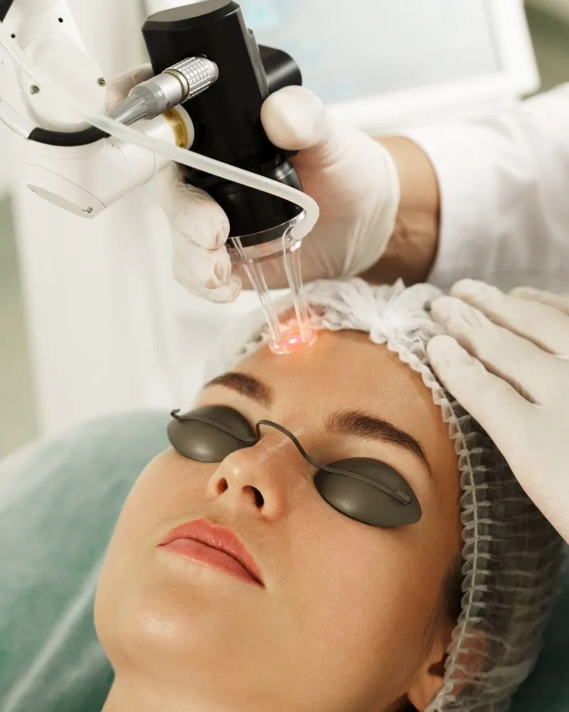 Best CO2 Laser Treatment In Vashi