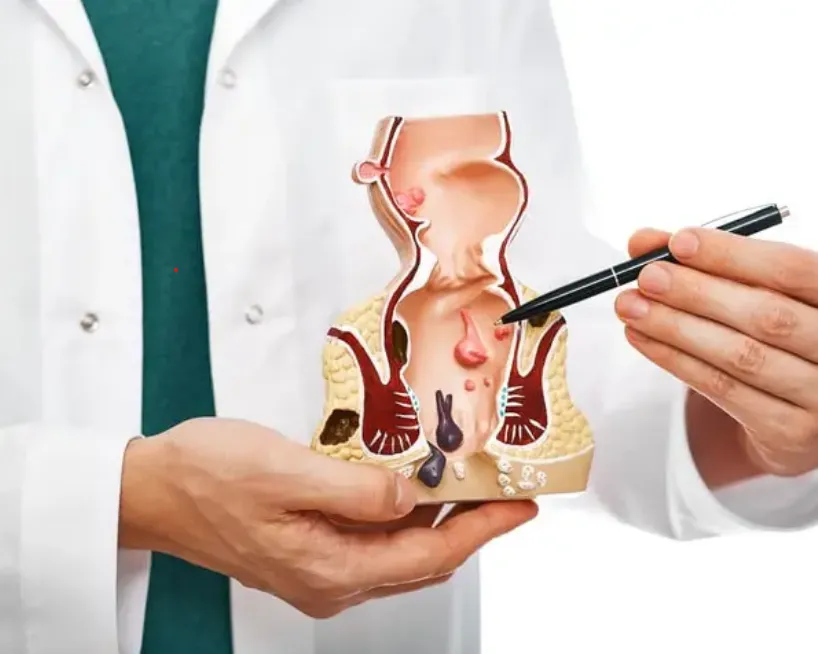 Laser Hemorrhoidoplasty