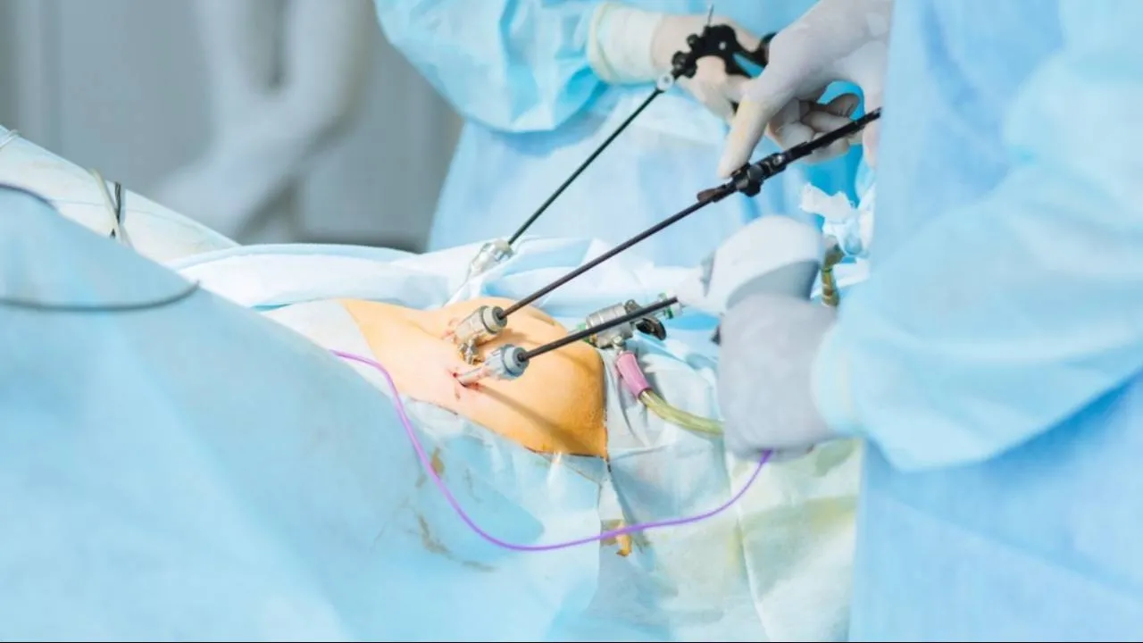 Laparoscopic Hernia Surgery in Chembur for Faster and Comfortable Recovery