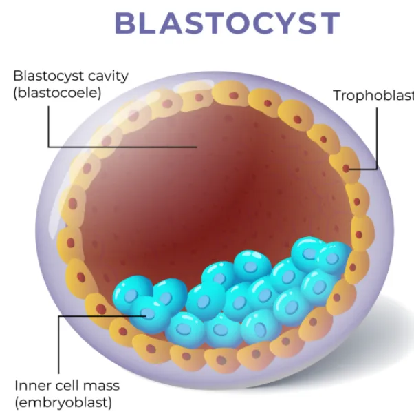Blastocyst transfer Procedure in Nashik for better implantation chances