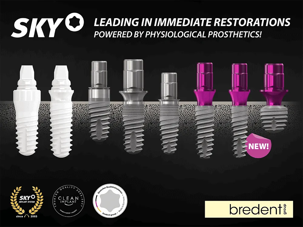 Bredent Dental Implants in Madhura Nagar Changing the Way Missing Teeth Are Replaced