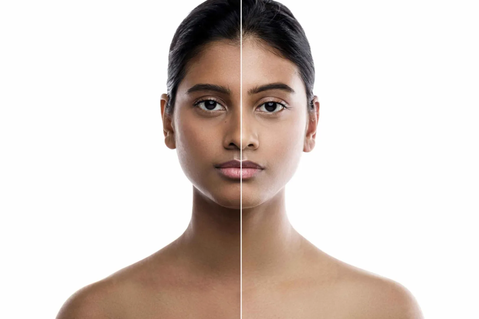 Skin Whitening Treatment in Delhi