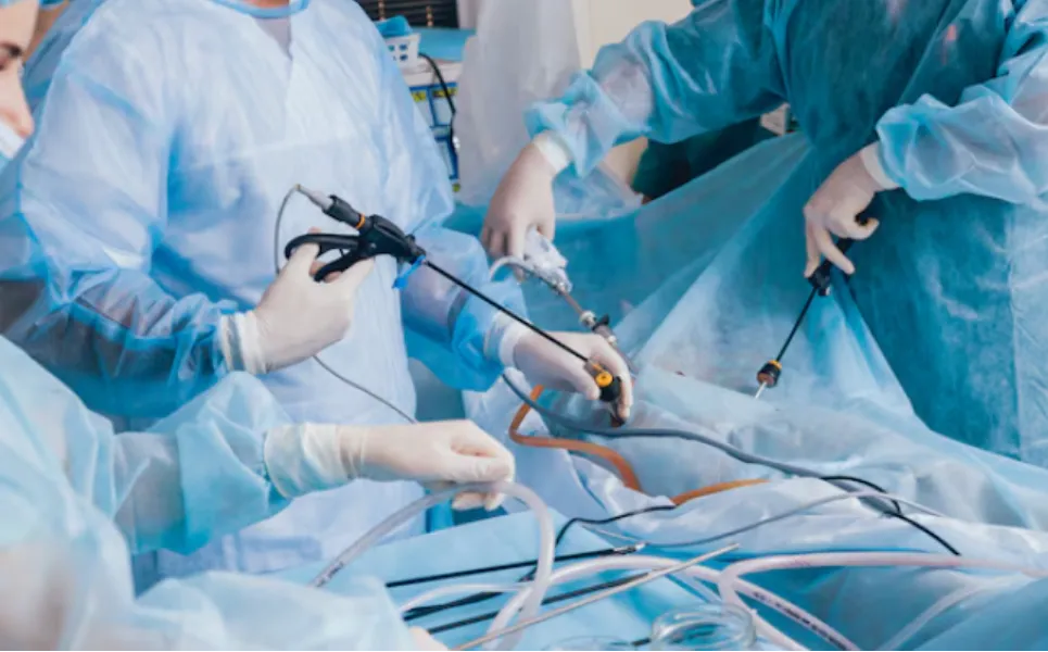 Laparoscopic Gastrectomy in Mumbai Central – A Modern Approach to Stomach Surgery
