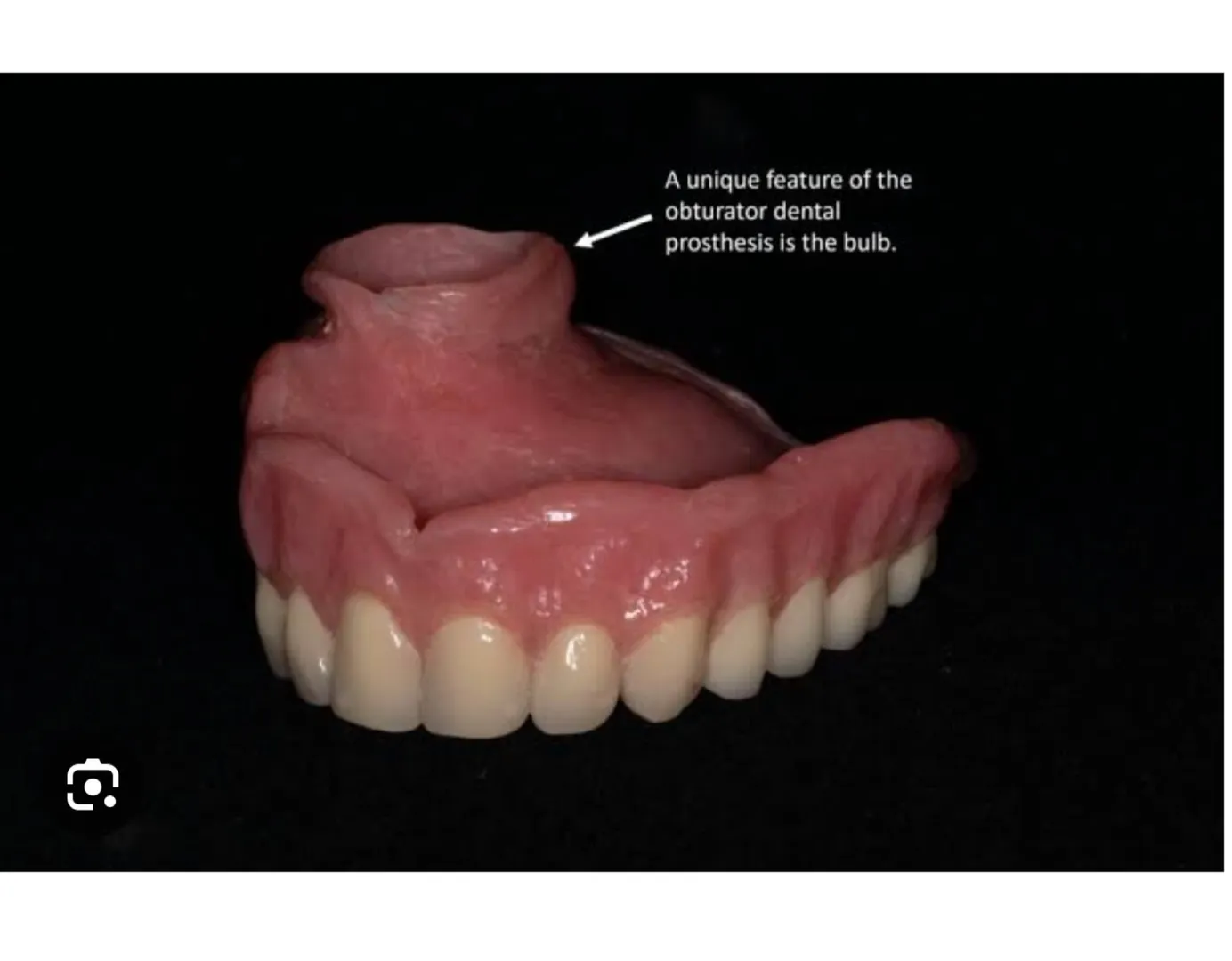 Maxillofacial Prosthesis - Palatal Obturator ( For cancer patients)