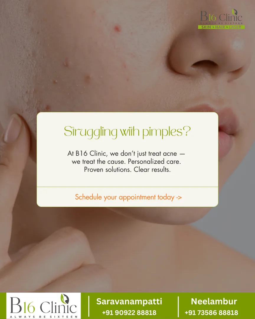 B16 Clinic (Skin • Hair • Laser)
Struggling with pimples or recurring acne? At B16 Clinic, we don’t...