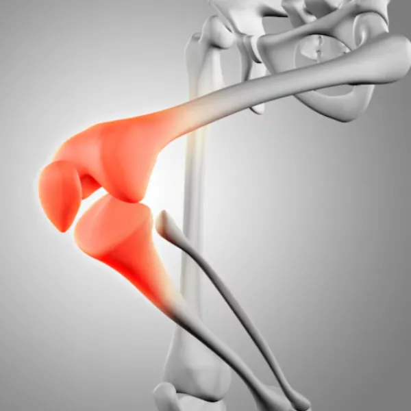 Orthopedic Surgeon in Model Town – Focused Treatment for Joint Problems