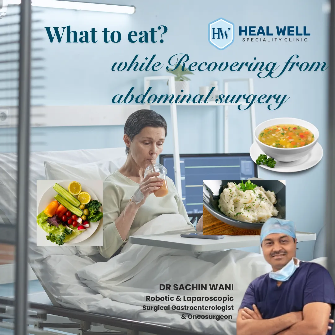 What to Eat After Abdominal Surgery?