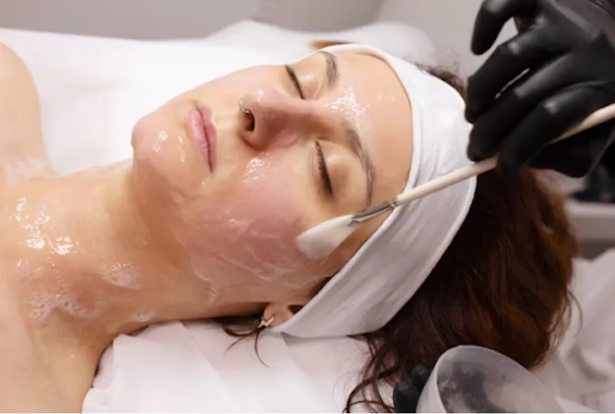 Chemical Peel Treatment near Kodambakkam – Reviving Skin Tone and Texture
