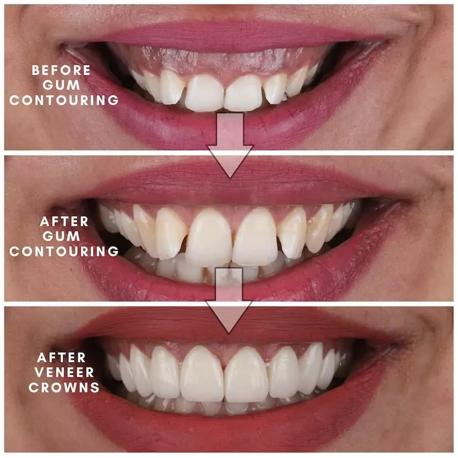 Gum Disease Treatment in Madhura Nagar That Looks Beyond Surface Issues