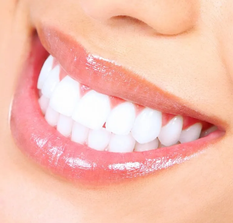 Best Tooth Whitening Treatment In Ghansoli