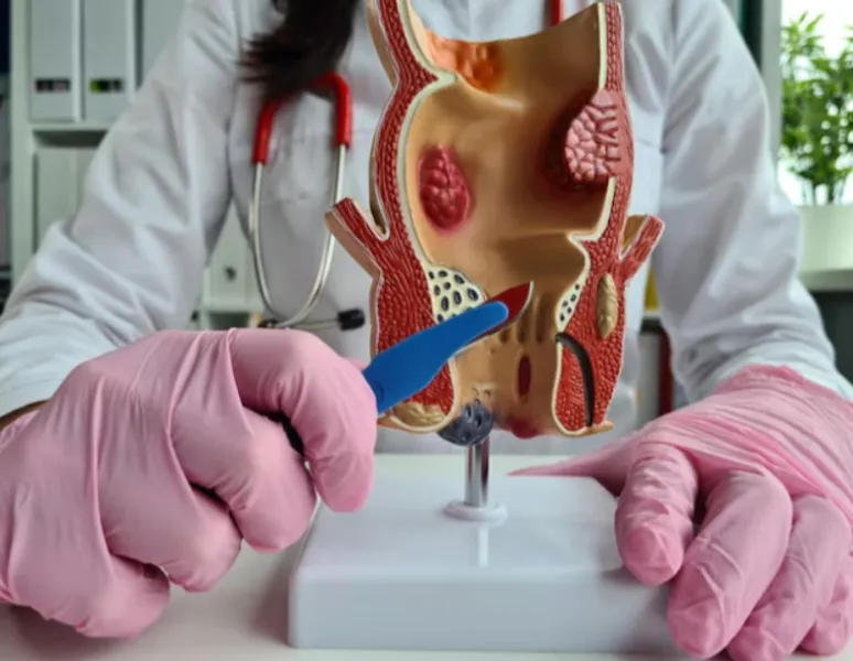 Piles Treatment in wakad