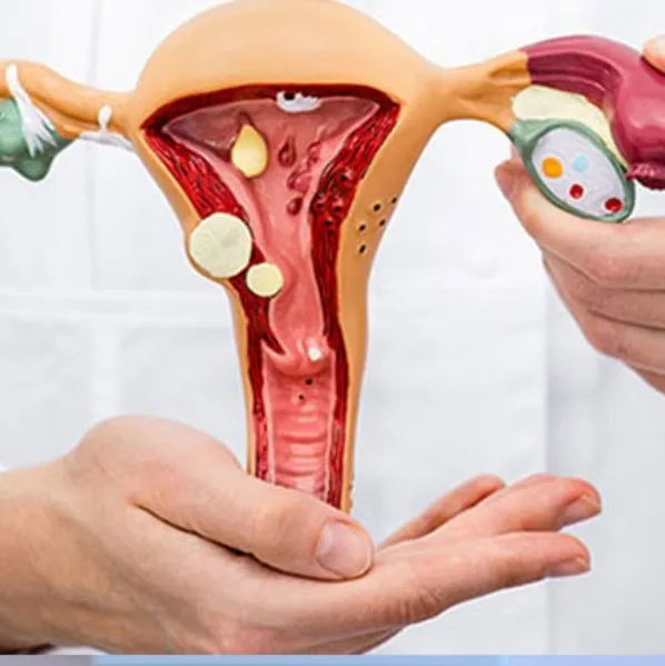 Looking for Best Endometriosis Surgeon in Pune