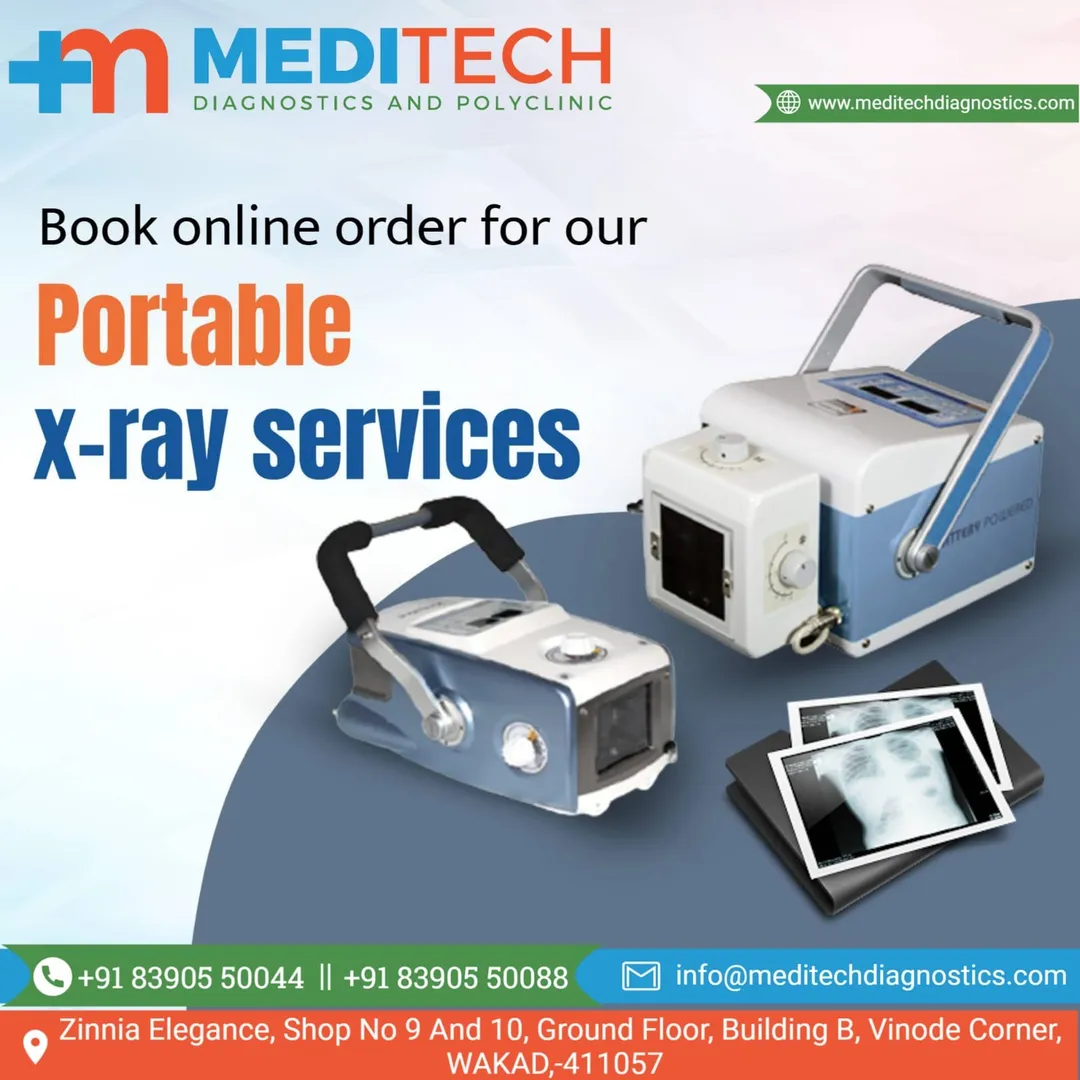 Best Portable Xray Services in Wakad | Best Portable Xray Services in Hinjewadi |