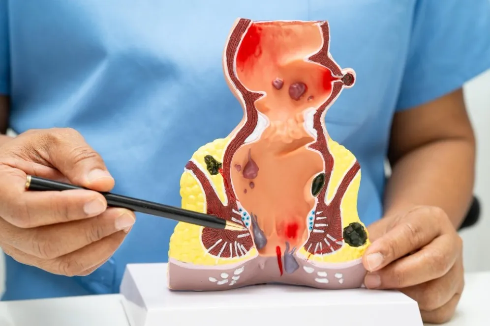 Anal Fissure Treatment in Chembur for Fast Relief and Healing
