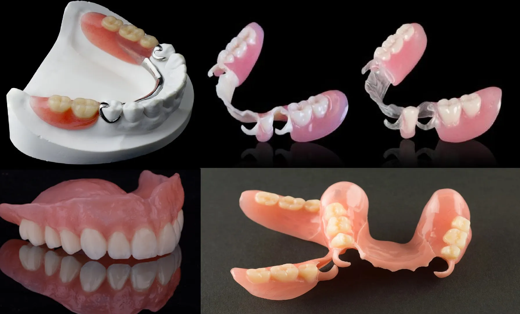 Complete Dentures in Madhura Nagar Restoring Balance and Confidence