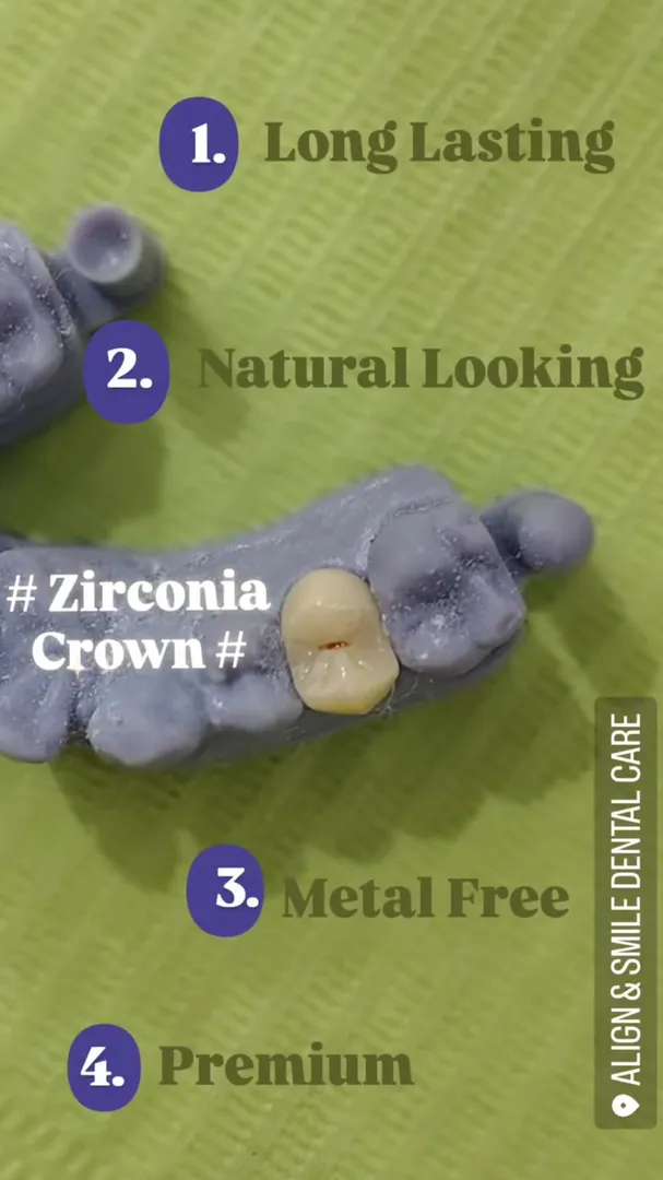 Importance of Zirconia Crown | Align & Smile Dental Care, Sector 18, Noida