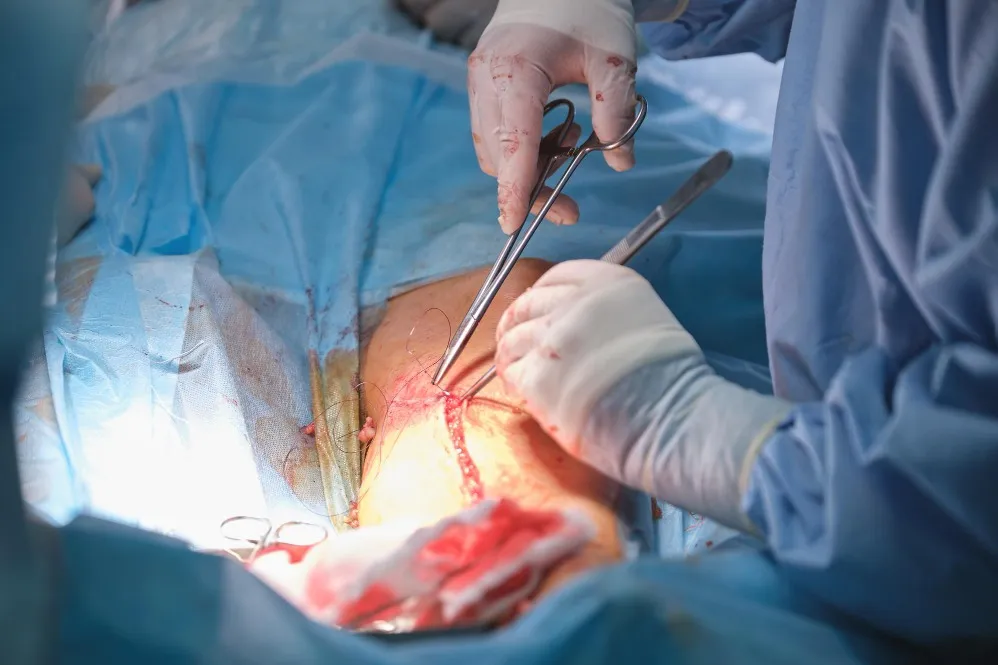 Thymectomy in Byculla – Advanced Treatment for Thymic Disorders