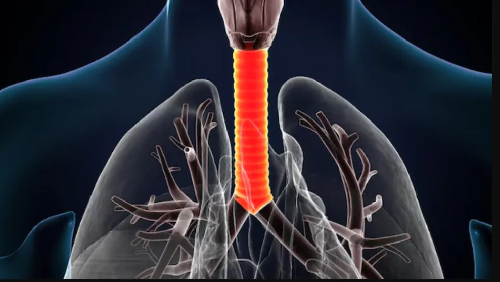 Tracheal Stenting for Airway Obstruction in Jaipur – Dr. Shubham Sharma