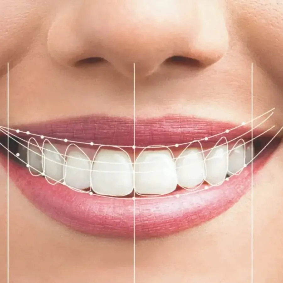 Smile design Treatment In Vashi
