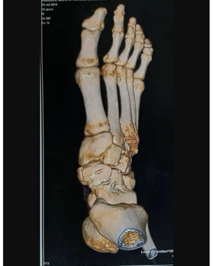 Emergency Orthopedic Doctor in Nagpur – Quick and Effective Care When You Need It Most