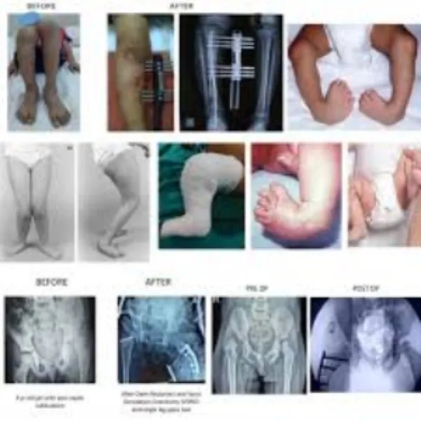 Best-Rated Orthopedic Doctor Near Me in Nagpur – Why Dr. Girish Motwani Is the Right Choice