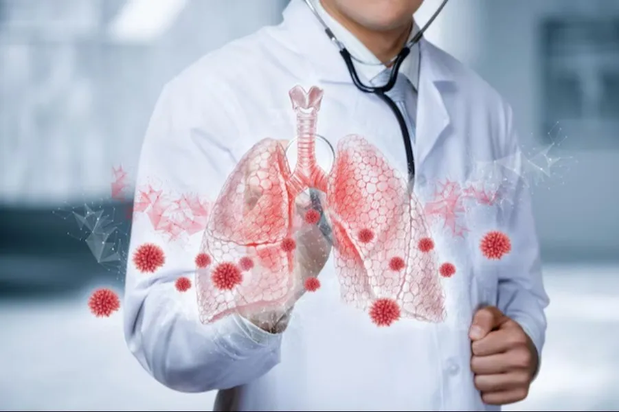 Understanding Lung Cancer and Its Early Signs – Dr. Shubham Sharma in Jaipur