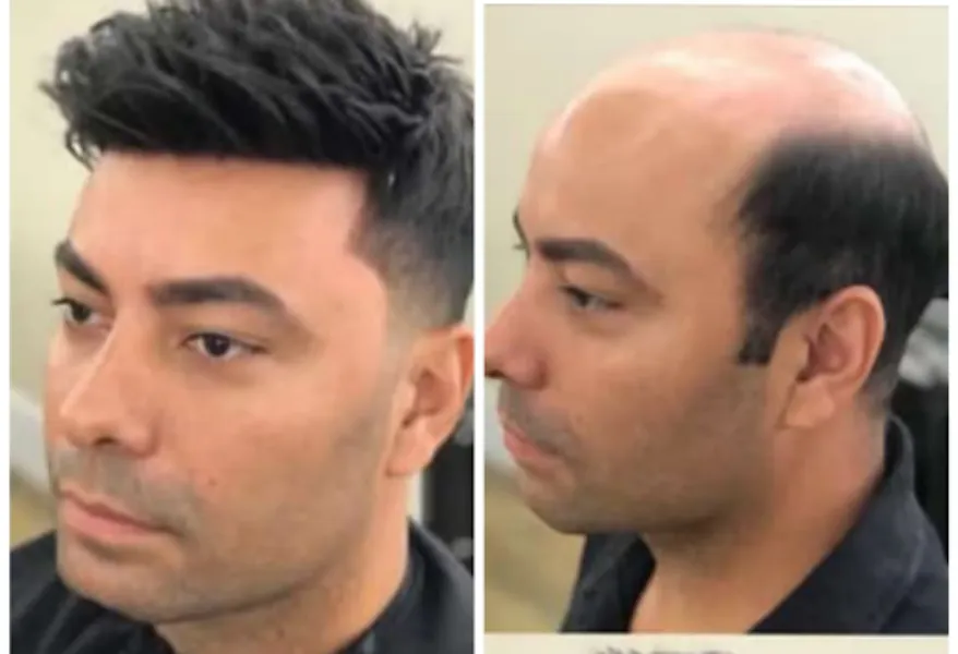 Gents Wig Center in Nagpur for Realistic and Practical Solutions