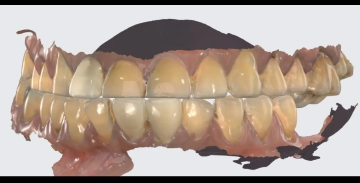 Intraoral Cameras – See What the Dentist Sees