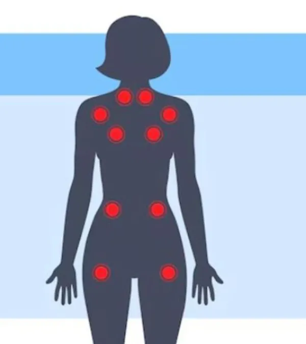 Fibromyalgia Treatment in Gurugram – Neurological Care for Chronic Widespread Pain