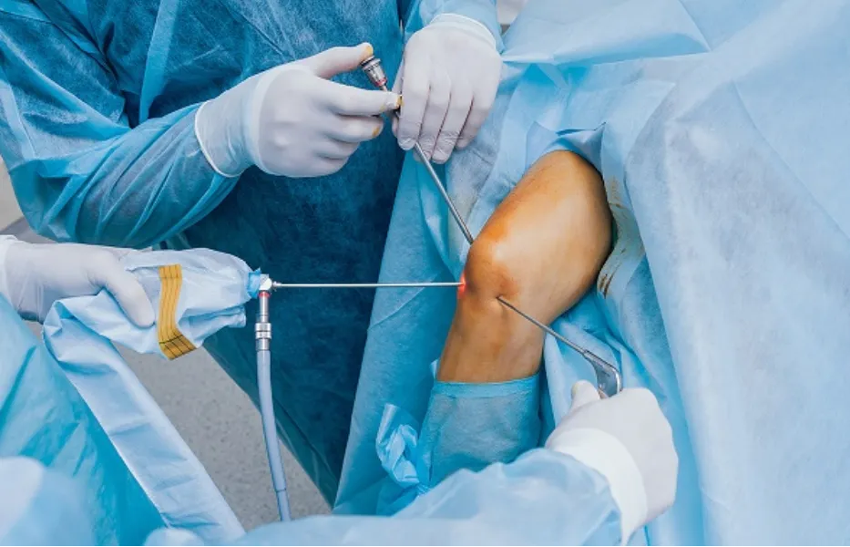 Knee Arthroscopy in Nagpur – Small Procedure, Meaningful Relief