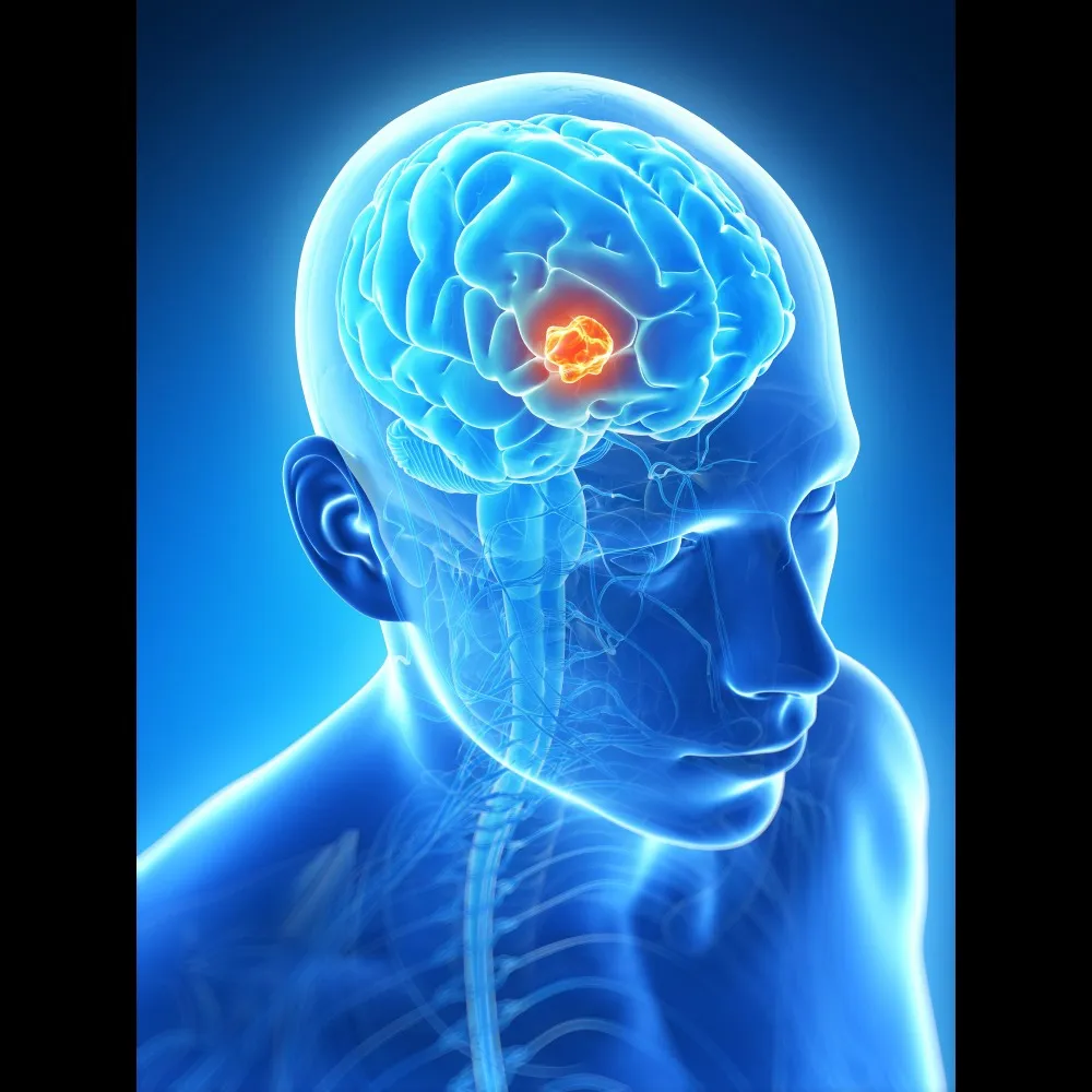 Traumatic Brain Injury (TBI) Treatment in Gurugram – Structured Care for Brain Recovery