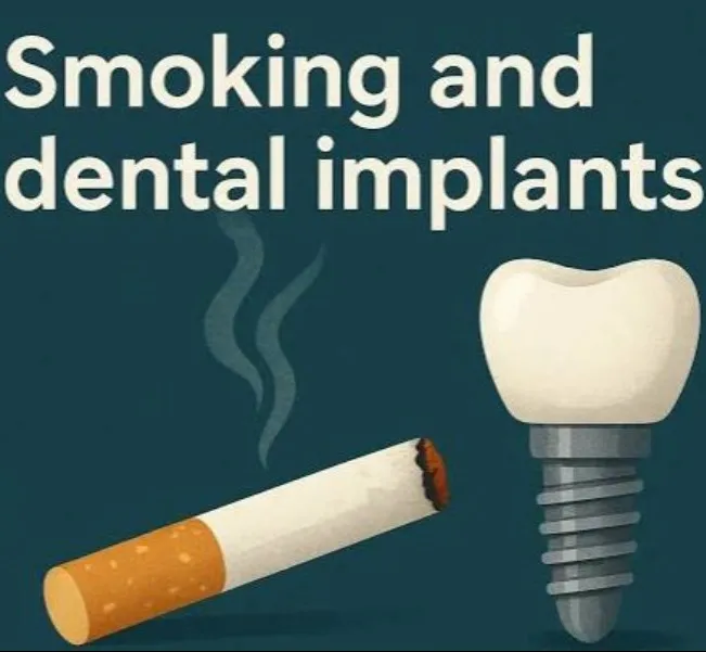 Smoking and Dental Implants – What You Should Know