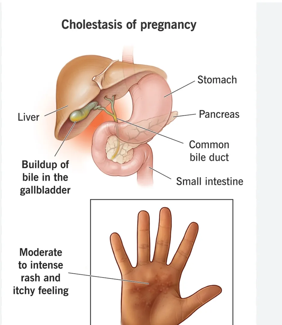 best Gynecologist doctor in Magarpatta City
