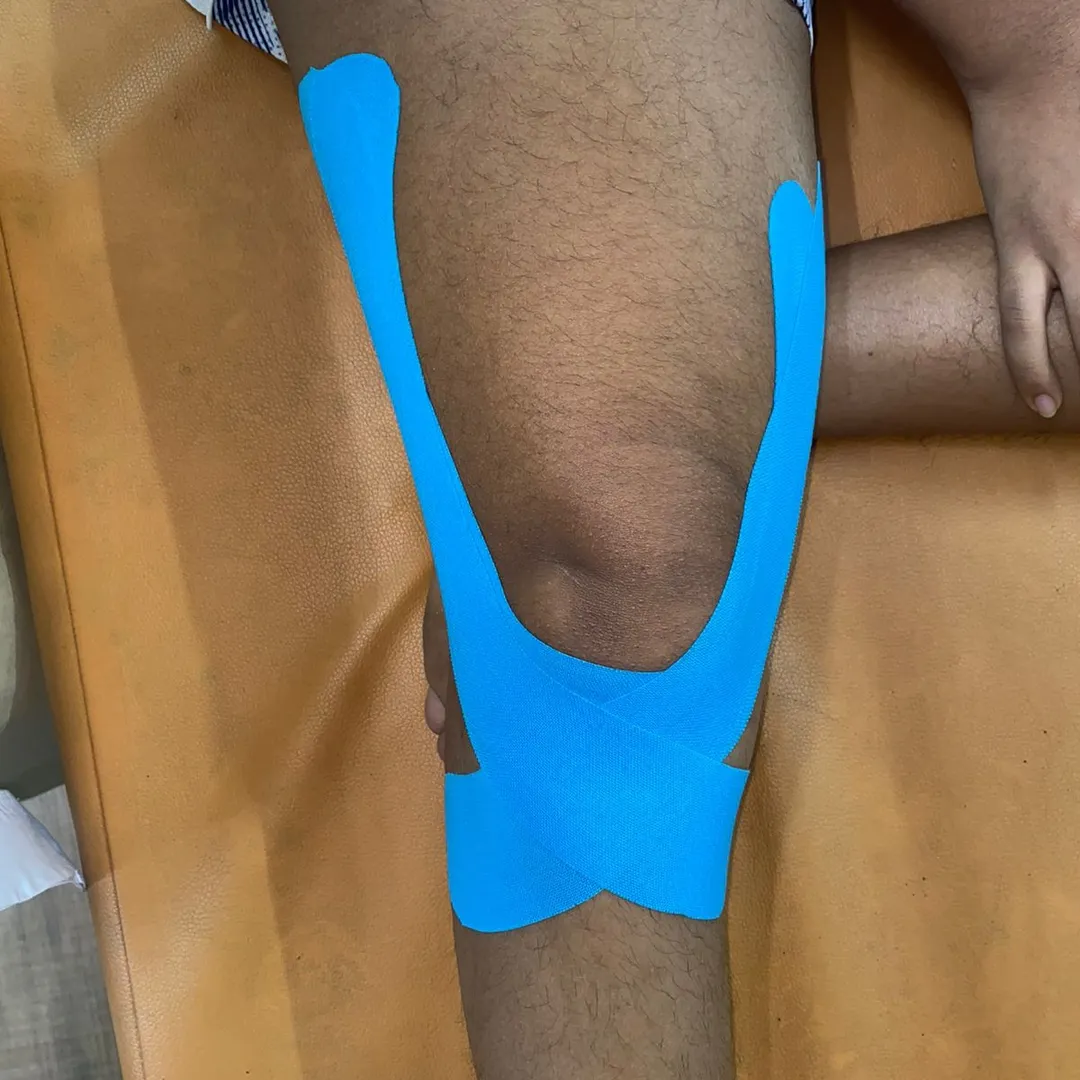 kinesiology taping for patello femoral stability