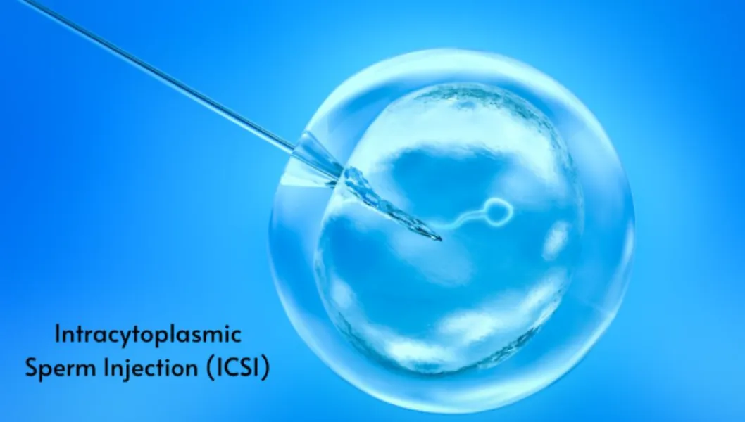 ICSI Treatment in Dadar | A Closer Look at Precision Based Fertility Care
