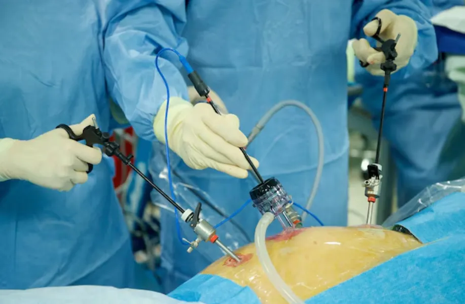 Laparoscopic Fundoplication Surgery in Kemps Corner – A Hope for Persistent Acid Reflux