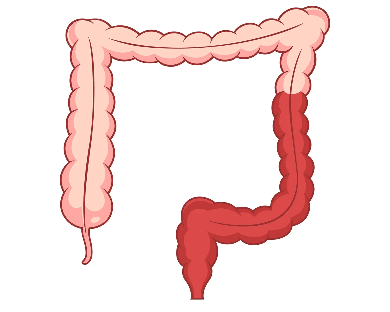 Ulcerative Colitis Treatment in Mumbai | Advanced Care for a Healthier Gut